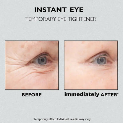 （✨Buy 2 Get 1 Free💕）Instant Wrinkle Eye Tightener cream🔥Last Day Sale 50% OFF🔥