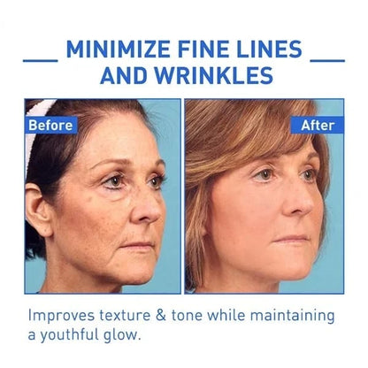 （✨Buy 2 Get 1 Free💕）Instant Wrinkle Eye Tightener cream🔥Last Day Sale 50% OFF🔥