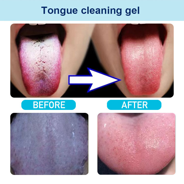 جل التنظيف Eelhoe Tongue ™ المزود بفرشاة
